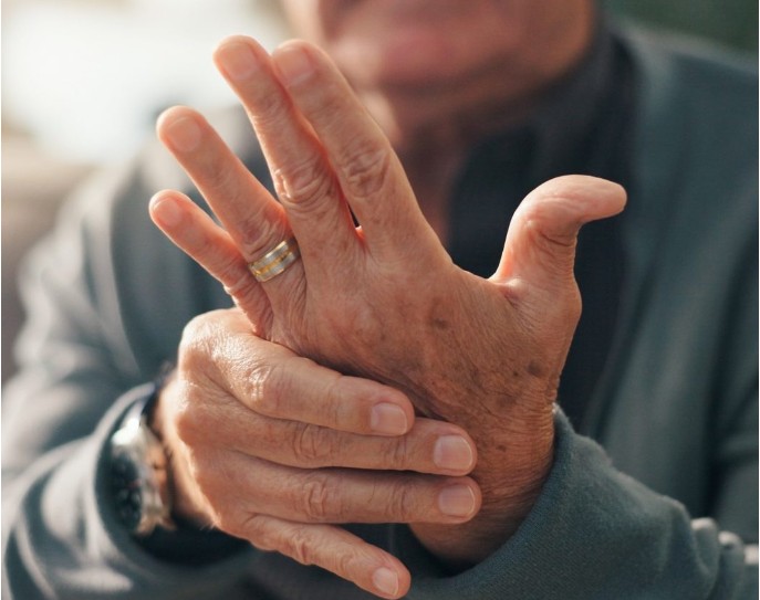 Air pollution can trigger painful rheumatoid arthritis flares